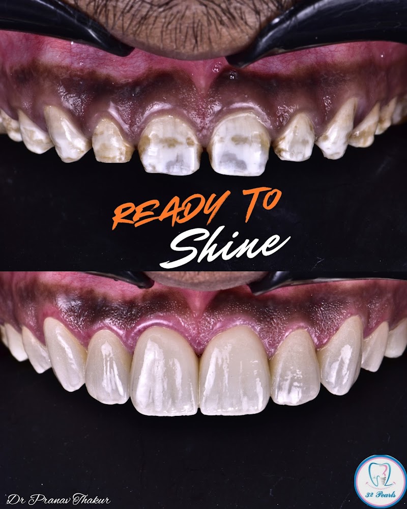 32 Pearls Dental Clinic and Implant Centre || Best Dentist in Raipur ||